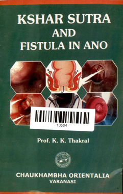 Kshar Sutra And Fistula In Ano
