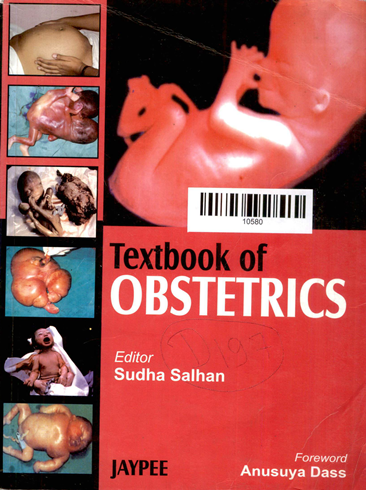 Text Book Of Obstetrics
