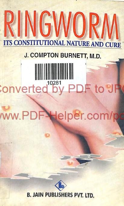 RINGWORM ITS CONSTITUTIONAL NATURE AND CURE