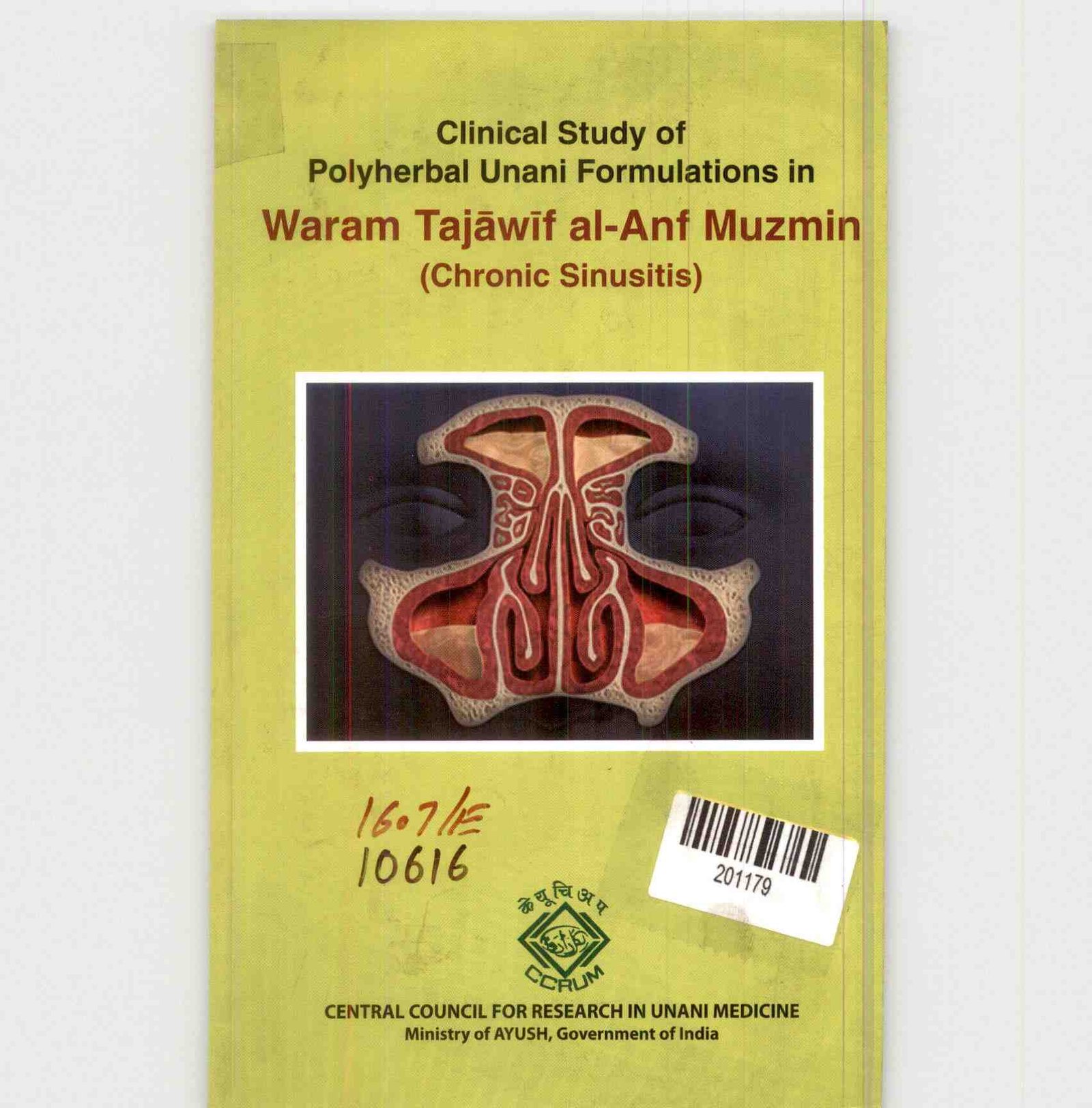 Clinical Study of Polyherbal Unani Formulations in Waram Tajāwīf Al-anf Muzmin (chronic Sinusitis)
